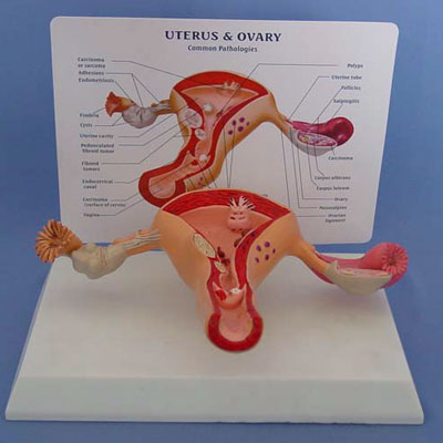 Human Size Female Uterus Ovary Anatomy Model Showing Common Pathologies