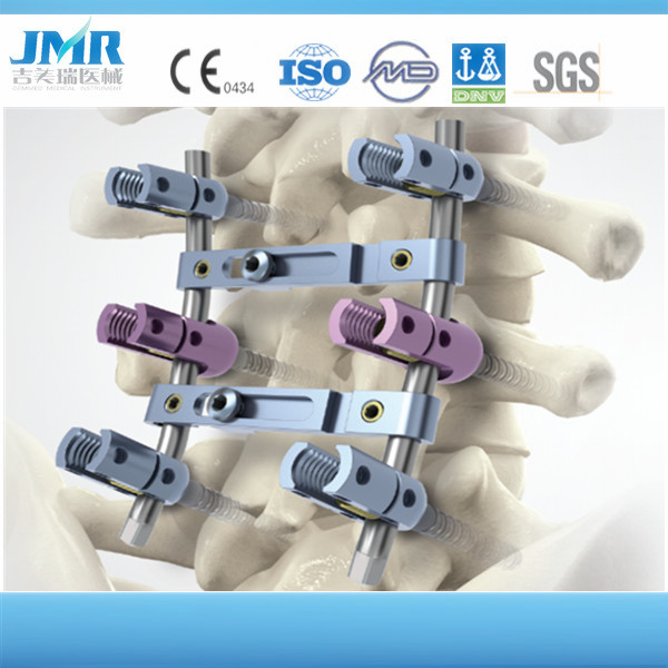 Orthopedic Implants Tibial Distal Lateral Locking Compression Plate Surgical Screws and Plates