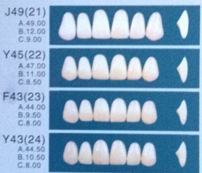 SA81 One Layer Whitening Veneers