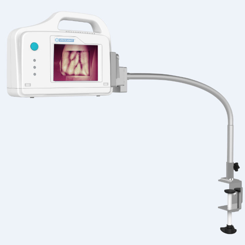 Pediatric Infrared Vein Illuminator Vein Detector Vein Finder (SC-B200)