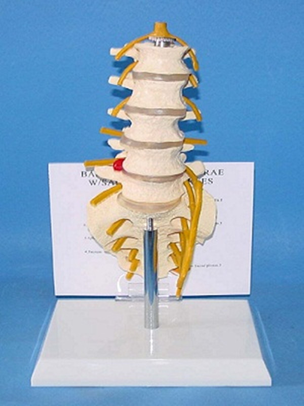 Human Anatomy Lumbar Vertebra Skeleton with Nerves (R020806)