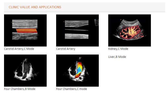 Ultrasound Scanner Color Doppler (SC-I9)