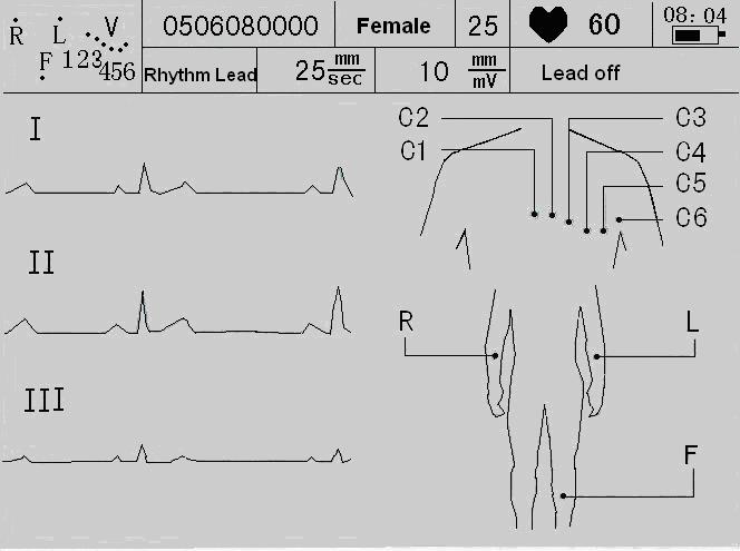 Three Leads Channel ECG Machine EKG Electrocardiograph Holter Paper Big Screen Ce Certificate (SC-CM300)