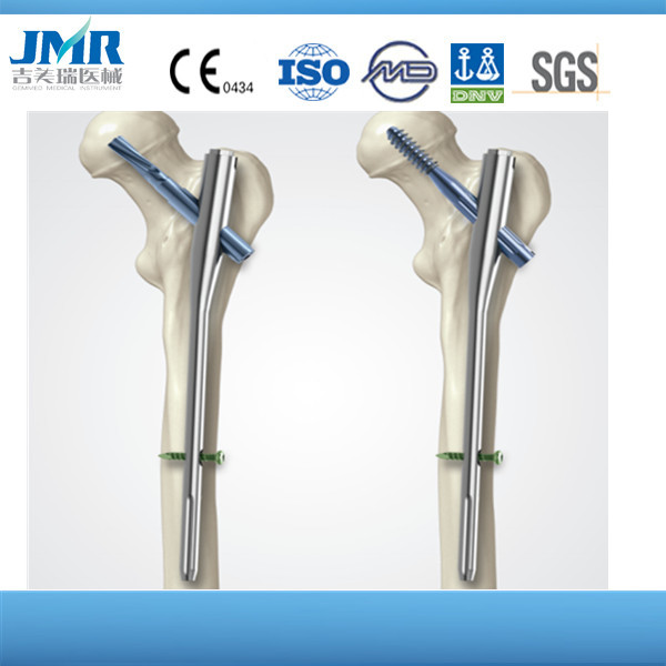 Tibial Interlocking Nail, Trauma, Orthopedic Impant, Intramedullary Nail