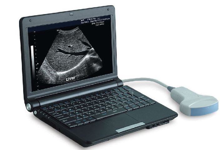 PT3000d1 Laptop Full Digital Ultrasound