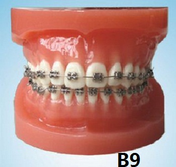 Oral Science Education Equipment Orthodontic Model Dental Model