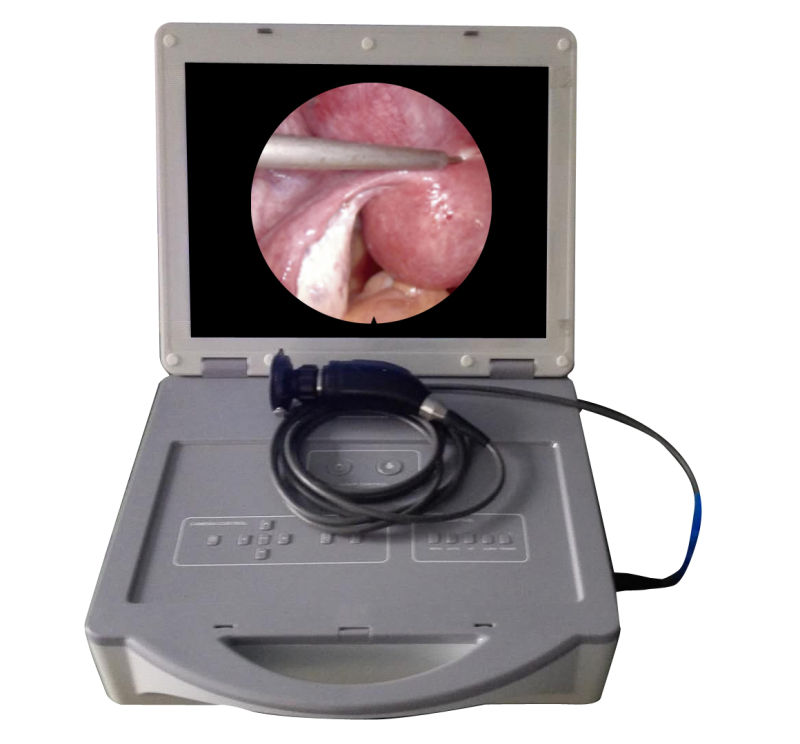 Veterinary Portable Medical Endoscope Camera with Light Source Screen