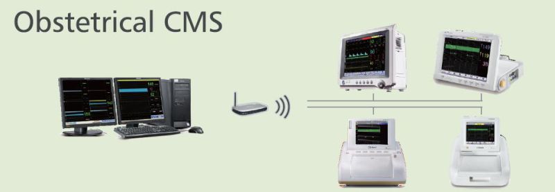 Ultrasound Doppler Twins Touchscreen Fetal Monitor with Ce (SC-STAR5000D)