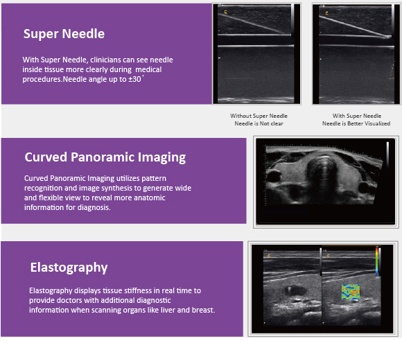 Ultrasound Scanner Color Doppler Laptop Portable (SC-Q9)