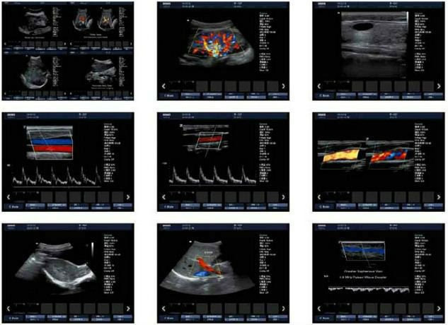 3D Color Doppler Portable Ultrasound Scanner (THR-CD580)