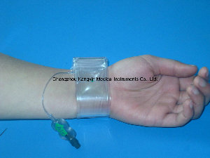 Radial Artery Compression Device (Balloon Tamponade)