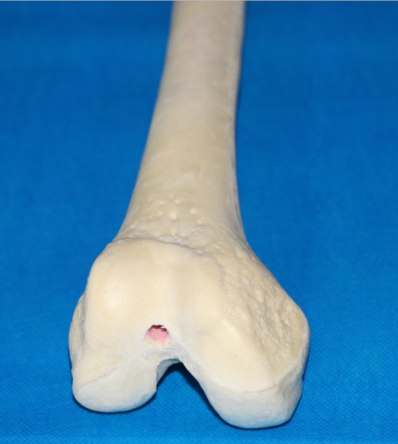 High Quality Femur Skeleton Bone Teaching Model (R010117)