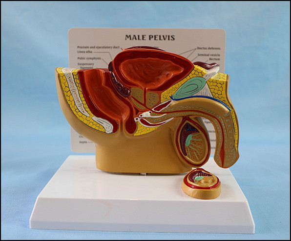 Medical Teaching Male Pelvis Anatomical Model with Common Disease