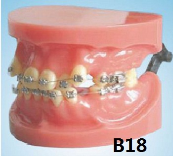 Oral Science Education Equipment Orthodontic Model Dental Model