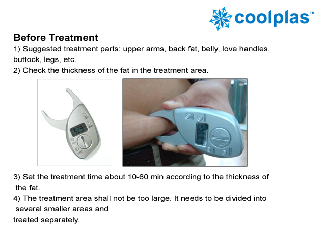 Cryolipolysis Slimming for Weight Loss Fat Freezing Reduction