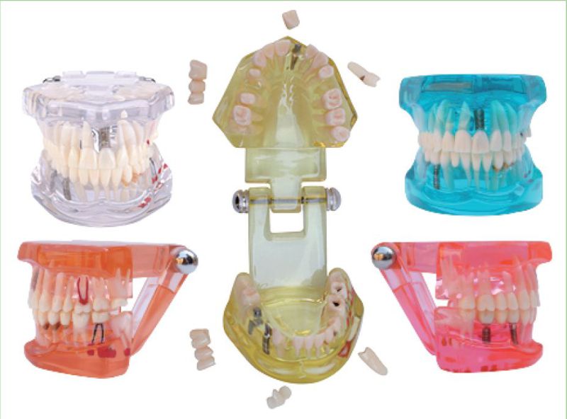 Oral Science Education Equipment Standard Dentition Teeth Model Denture Model