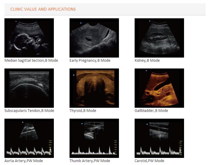 Ultrasonic Ultrasound Scanner Black White Doppler Laptop Portable (SC-ECO2)