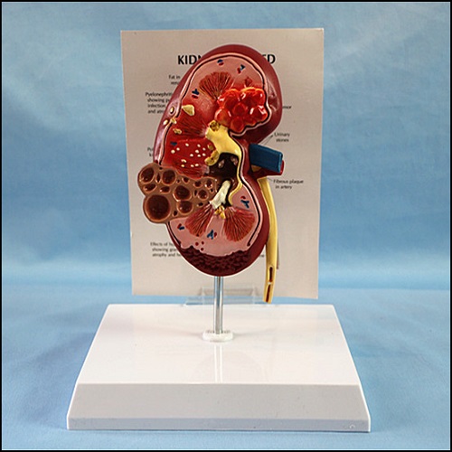 PVC Human Kidney Anatomical Model for Sale