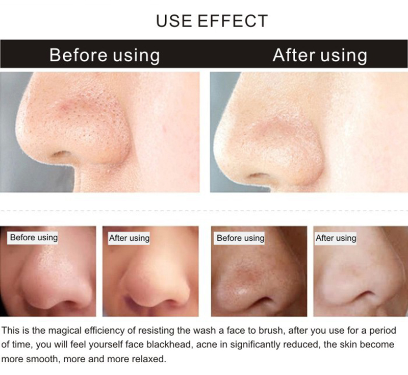Unique Design Best Quality Deep Cleansing Face Pore New Facial Brush