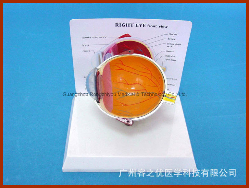 Pathological Model Disease Eye Anatomical Model