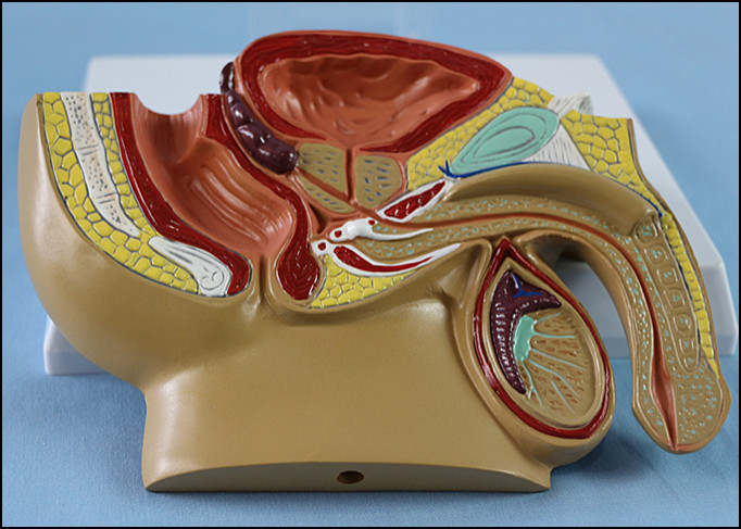 Medical Teaching Male Pelvis Anatomical Model with Common Disease