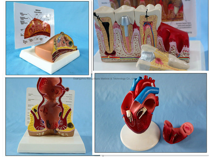 Desk Type Model Breast Anatomical Model / Pathological