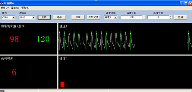 Blood Oxygen Monitor OLED Neonatal Oximeter SpO2 Monitor