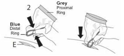 Disposable Wound Retractor for Endoscope Surgery