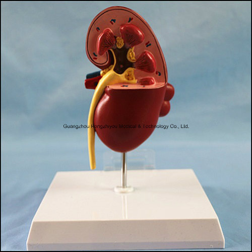 PVC Human Kidney Anatomical Model for Sale