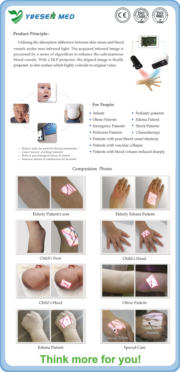 Ysvv-300 Portable Medical Hospital Vein Finder