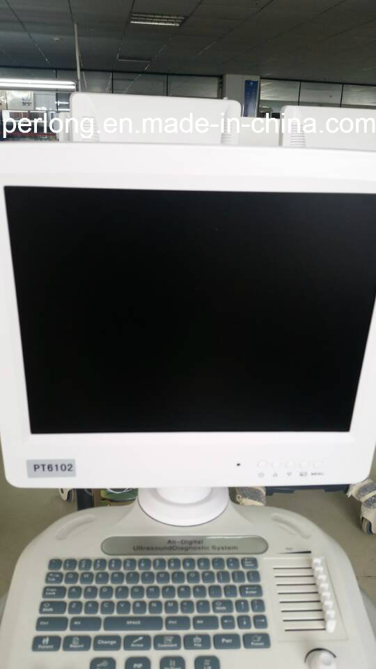 Digital Ultrasound Diagnosis System PT6102