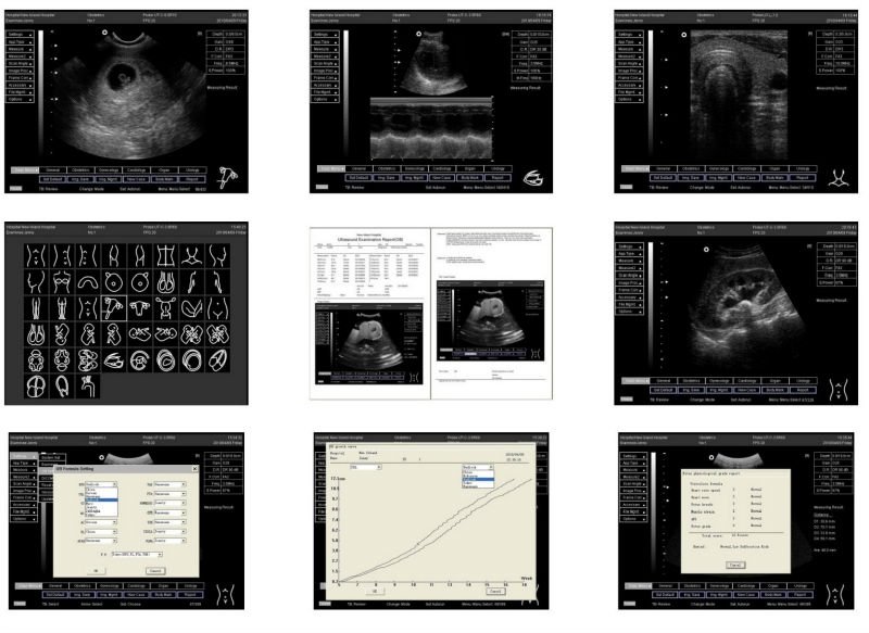 High Quality Full Digital Ultrasound Scanner (THR-US9902)