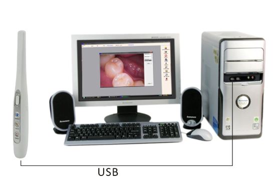 2.0 Mega Economical USB Dental Product Camera