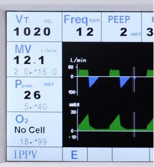 Veterinary Anesthesia Machine Ventilator Cwm-201A