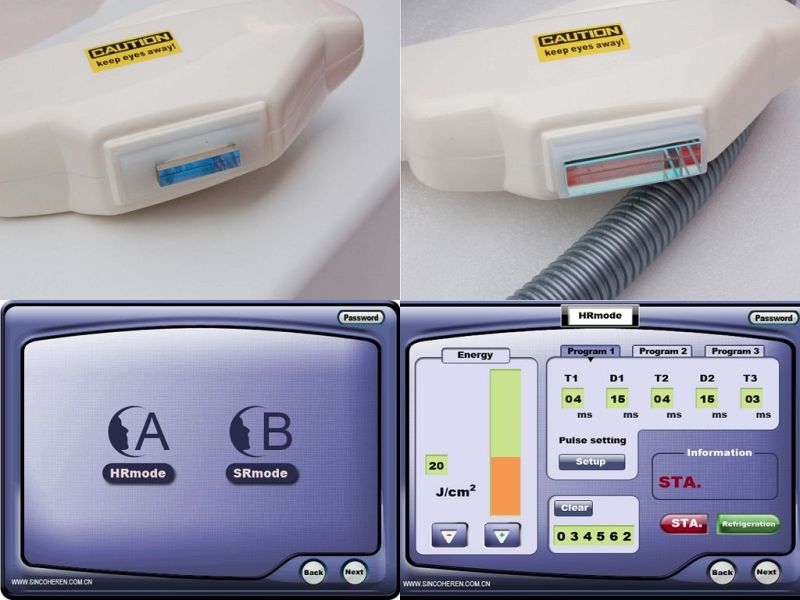 CE Certified Sienna IPL Aesthetic Equipment Tga Approved