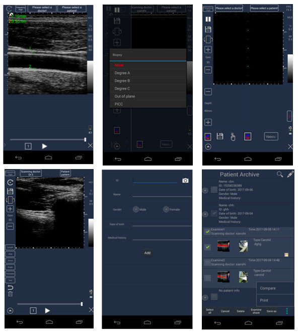 C-Scan Handheld Touch Screen Color Ultrasound