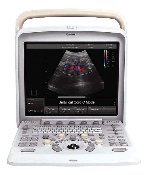 Medical Equipment Portable 4D Color Doppler Ultrasound Machine with Price