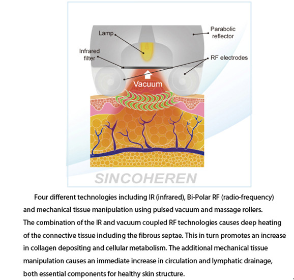 Beijing Sincoheren Kumashape Cellulite/Fat Reduction Slimming Therapy Machine