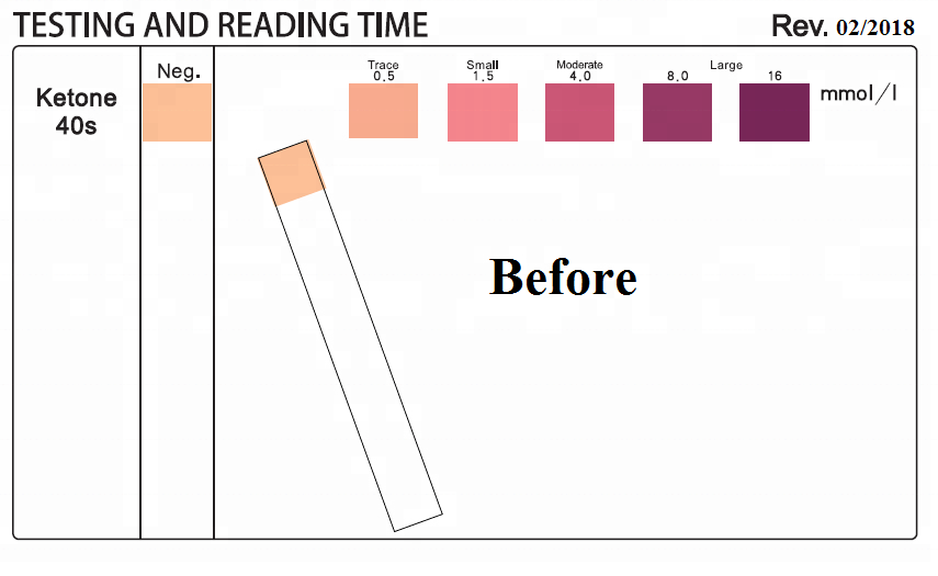 Ketone Test Kit For Urinalysis