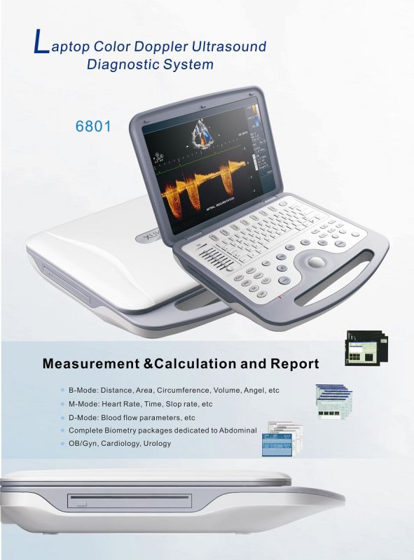 High Quality Full Digital Ultrasound Scanner (XT-FL038)