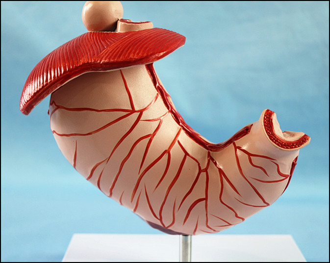 Human Stomach with Ulcers Anatomical Model