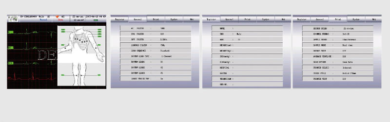 Twelve Lead Channel ECG Machine EKG Electrocardiograph Holter Big Touch Screen Ce Certificate (SC-CM1200B)