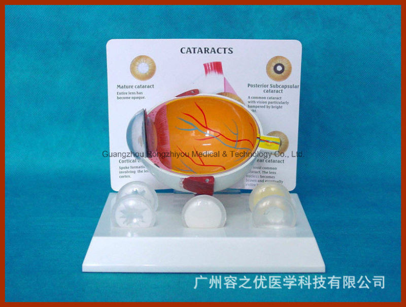 Desk Type Model Eye Anatomical Model Health Half Anatomic Eye Model