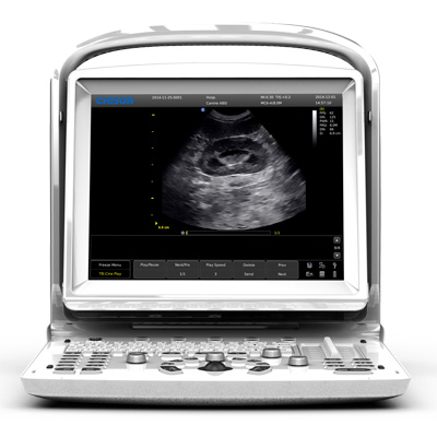 Ultrasonic, Ultrasound Scanner Black White Doppler Laptop Portable (SC-ECO3 expert)