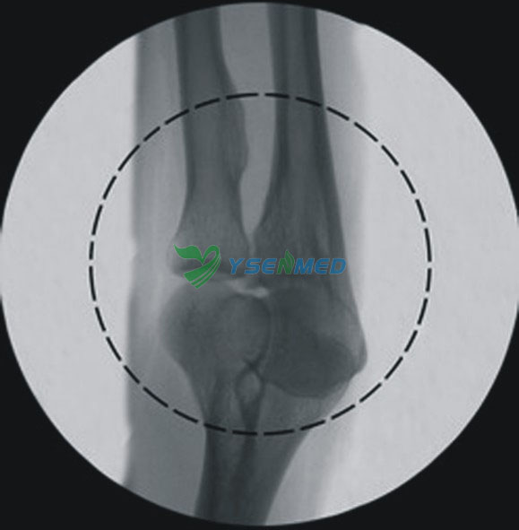 Medical High Frequency X-ray Mobile Digital C-Arm Machine