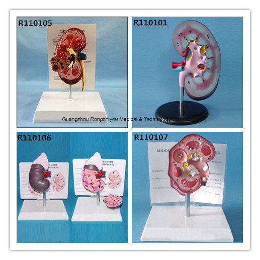 PVC Human Kidney Anatomical Model for Sale