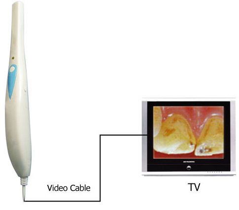 Dt870 Wired Video/RCA Rechargeable Intra Oral Camera with 1.30mega Pixels