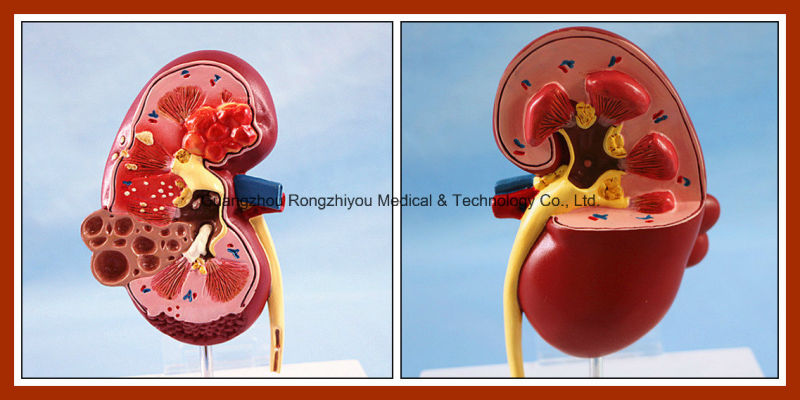 PVC Human Kidney Anatomical Model for Sale