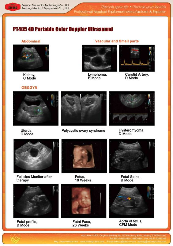 PT450 4D Color Dopplor Ultrasound Machine