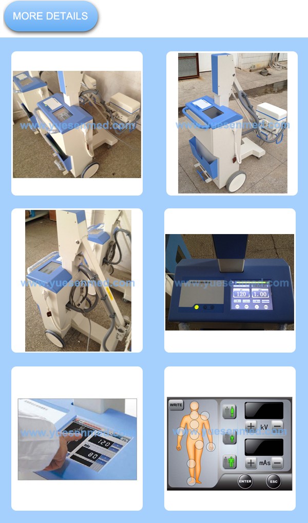 Mobile High Frequency X-ray Equipment